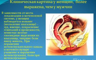 Выделения из уретры у женщин — диагностика и последствия