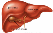 Эмпиема желчного пузыря – скопление гноя в полости мешковидного органа