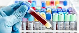 Анализ крови АЛТ: что это и как его правильно проводить?