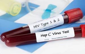Гепатит и ВИЧ это одно и тоже или это разные заболевания