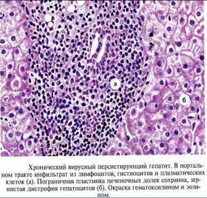 Персистирующий гепатит – сложности диагностики воспаления печени