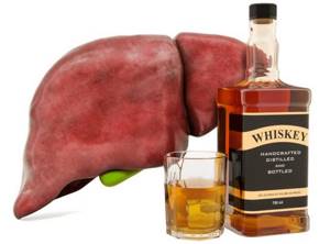 Алкогольная болезнь печени – разрушение органа под действием алкоголя