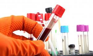 Желчные кислоты: анализ крови на функционирование печени и ее структур