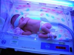 Конъюгационная желтуха – повышение билирубина в крови у новорожденных