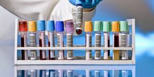 Анализ на гепатит – важное лабораторное исследования для диагностирования заболевания