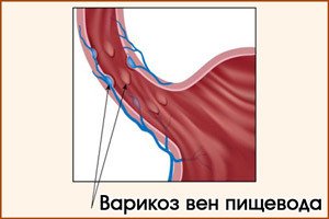 Дисфункция печени – нарушение деятельности паренхиматозного органа