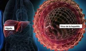 Гепатит инфекционный: виды, симптомы, способы терапии
