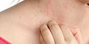 Сыпь при гепатите – результат нарушения функциональности печени
