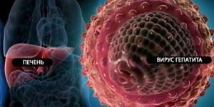 Гепатит С генотип 1а – один из вариантов опасной гепатотропной инфекции