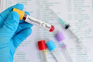 Анализ на гепатит и ВИЧ входит в комплекс обязательных обследований
