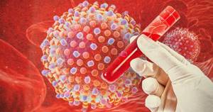 Вирусная нагрузка при гепатите С – концентрация вирусных РНК в крови
