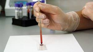 Анализ крови АЛТ: что это и как его правильно проводить?
