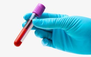Анализ крови, АЛТ, АСТ, билирубин – что такое, и каковы показатели нормы