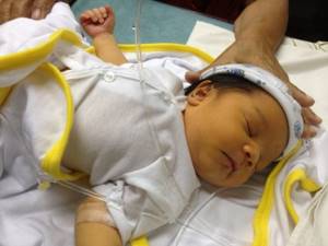 Как снизить билирубин у новорожденного, причины, симптомы и лечение