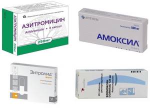 Антибиотики при холецистите: разнообразие лекарств и правила применения
