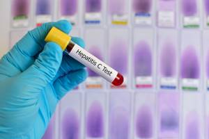 Расшифровка количественного анализа на вирус гепатита С