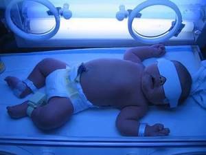 Желтуха у новорожденных: причины и способы лечения