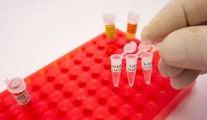 ПЦР на гепатит В – исследование крови с высокой точностью результата