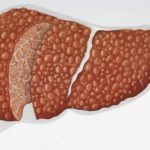 КВР печени – один из параметров, применяемых в диагностике болезней органа
