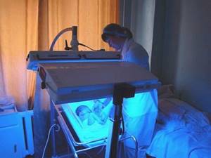 Особенности развития физиологической желтухи у новорожденного ребенка