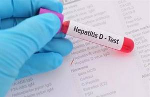 Гепатит Д: основные причины, симптомы и лечение