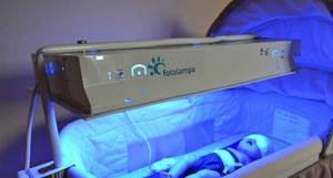 Лампа от желтушки для новорожденного – действенная фототерапия