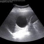 КВР печени – один из параметров, применяемых в диагностике болезней органа