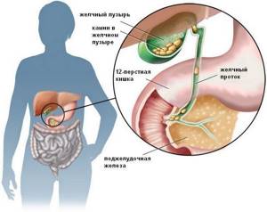 Где находится желчный пузырь: основные функции и заболевания органа