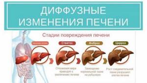 Диффузные изменения печени и поджелудочной железы, гепатомегалия